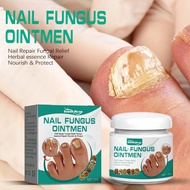 Nail Fungus Treatments Serum Cream Anti Fungal Foot Toe Nails Repair Gel Anti-Infection Onychomycosis Paronychia Care Ointment