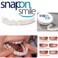 Snap On Smile Veneer Gigi Palsu Lengkap - Perapih Gigi Vener White Ori