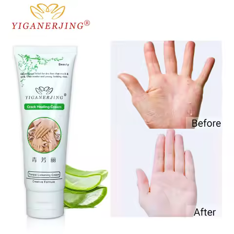 2Pc YIGANERJING Hand Cream Hydrating Moisturizing Repair Dry Rough Hand Care Non-Greasy Hand Lotion 