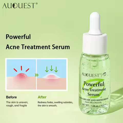 AUQUEST Salicylic Acid Acne Treatment Face Serum Oil Control Herbal Fades Acne Marks Pimple Remover 