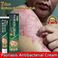 Eczema Treatment Cream Original Ointment Eczema Treatment Cream Anti Fungal Cream Psoriasis Treatmen