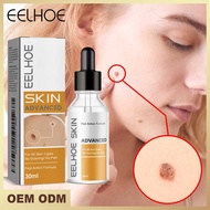 EELHOE EELHOE Essence Deep Cleansing Smooth Skin Fade Hands Foot Corns Eyes EELHOE Essence