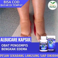 Obat Penghilang Edema Herbal Alami - Obat Pengempes Bengkak Edema Obat Diuretik Edema Obat Penyakit 