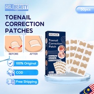 EELHOE Ingrown Toenail Correction Patch Ingrown Toenail Correction & Repair Toenail Correction Patch
