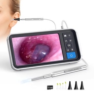 3.9mm 4.5 Inch IPS Color Screen Smart Digital Video Otoscope 1.0MP 1080P HD Lens with Ear Inspection