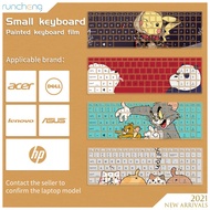 Keyboard skin cover custom pattern, cartoon pictures keyboard decoration, silicone material, suitable for Huawei, Lenovo, Acer, Dell, asus laptop keyboard film