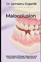 Malocclusion: Etiology, Diagnosis, and Integrated Therapeutic Approaches
