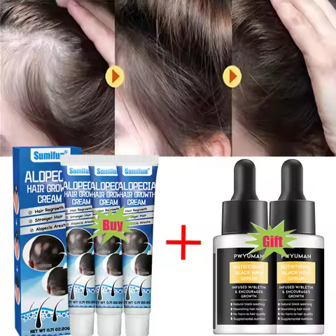 7 days Fast Hair Growth Cream Anti Hair loss Prevent Baldness Scalp Treatment Repair Roots Beauty He