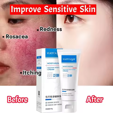 B5 Repair Facial Redness Cream Instant Spider Vein Remove Sensitive Skin Sooth Anti Redness Rosacea 