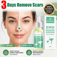 30ml DermaLab Emu Renew Serum for Pitted Scar Treatment