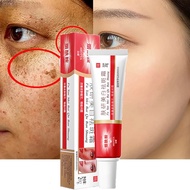 Effective Melasma Remover Cream Collagen Pekas Remover Original Dark Spot Remover Whitening Cream