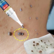 [HCM]TAG&WART REMOVER Tẩy nốt ruồi xóa mụn ruồi trên mặt tàn nhang mụn cóc mụn thịt  mụn cơm mắt cá 