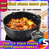 【Malaysia Spot Sale】Non Stick Marble Stone 16/18/20CM Saucepan Light Weight Cooking Pot Milk Pot wit