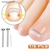 Bgree Ingrown Toenail Correction Tool Toenail Recovery Ingrown Toenail .