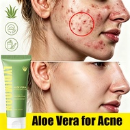 Aloe vera acne-removing body lotion, whitening, scar-removing, can moisturize dry skin, balance oil 