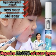 Repairs 99.99% of scar types Scar removal laser pen for hypertrophic scars, new scars, old scars sca
