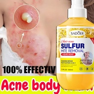 Sulfur shower gel removes mites, inhibits bacteria, relieves itching, moisturizes the skin. Sulfur s