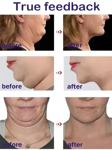 Effective V-Shape Face Slimming Lifting Facial Cream Lift Up V Double Chin Cheek Slimming Firming An