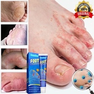 eczema cream itchy skin cream foot fungus treatment psoriasis cream foot peeling foot deodorant 腳氣膏