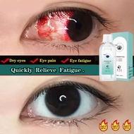 200ml Eye Wash & Eye Care Solution Cleansing Moisturizing Eye Fatigue Relief Liquid