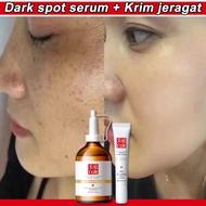 Dark spot serum Krim jeragat Hyaluronic acid serum Brightening serum 美白祛斑霜 / moisturiser / jeragat degil berkesan