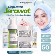 Ms Glow Acne Skincare Facial Package New DTE Mini Official Store Skincare for Acne and Oily Skin