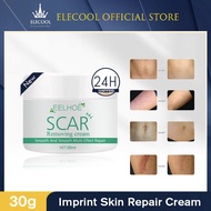 EELHOE Scar Removal Cream Effective Removes Acne Pimples Stretch Mark Scar Repair Cream Fades Burn Scars Promotes 30ml -acerver
