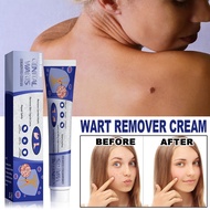 South Moon Genital Warts Remover Cream biji kolestrol Mole Removal Wart Cream Wart Removal Ointment 