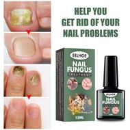 EELHOE Nail Fungus Treatment Nail Repair Essence Anti-fungal Nail Fungal Treatment Nail Care