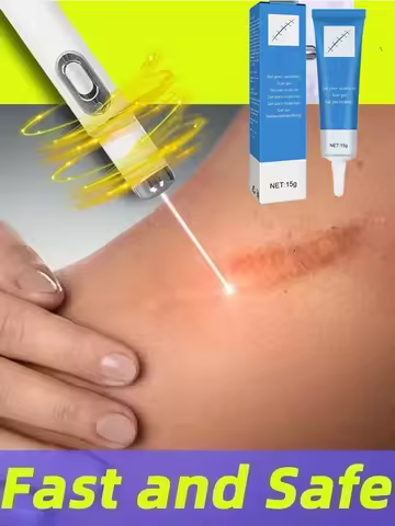 Laser Therapy Keloid Scar Improve Keloid Scar Pen Scar Relief Easy Harmless Laser Pointer