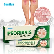 100% Natural Cost Eczema Cream, Herbal Eczema Cream, Moisturizing Cream