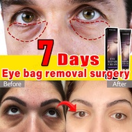 【Imported from South Korea】7 days to remove dark circles dark circle cream to reduce dark circles da