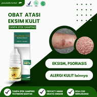 Propolis SM Obat Eksimer Kuning Kering Basah Gatal Budug Kurap Herpes Zoster Kurap Lingkaran Merah