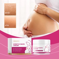 EELHOE Stretch Mark Cream Stretch Mark Scar Removal Massage Cream Stretch Mark Mark Care Cream Skin 