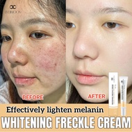 Whitening Freckle Cream Freckles Removal Pigmentation Chloasma Dark Black Spot Remover Reduces Melanin Firming 祛斑霜 20g