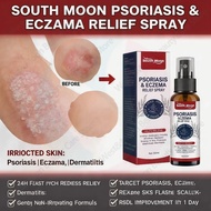 【𝟐𝟒 𝐇𝐨𝐮𝐫𝐬 𝐃𝐞𝐥𝐢𝐯𝐞𝐫𝐲】Herbal Cream Spray Psoriasis Eczema Kulat Gatal Ekzema Kurap Anti Bacterial Anti 
