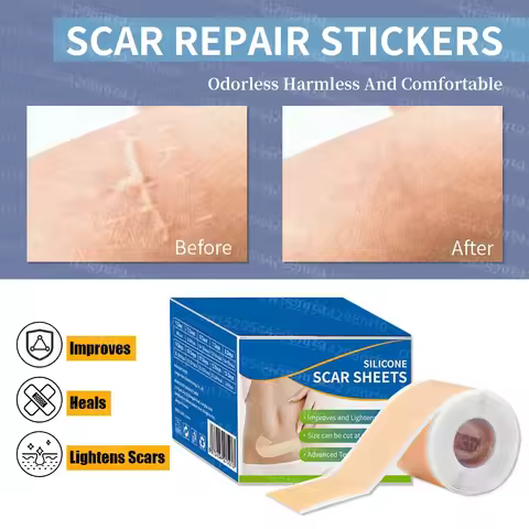 Silicone Scar Patch Silicone Scar Tape Roll Scar Sheet Removal Self-Adhesive Tape Therapy Patch Burn