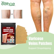 Varicose Vein Treatment Patch Treat Spider Leg Edema Nerve Pain Blocked Blood Vessels Relief Phlebit