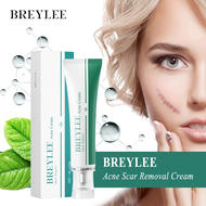 ครีมลดรอยแผลเป็น ลดผิวแตกลาย ครีมลดรอยแผลเป็น Repair Scar Cream ครีมลบรอยแผลเป็นจากสิว ครีมทาแผลเป็น
