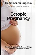 Ectopic Pregnancy: Pathophysiology, Diagnosis, and Management