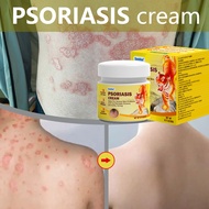 Psoriasis Cream Antifungal cream Eczema cream Cream gatal kulit 20g krim gatal kulit herba cina Ubat