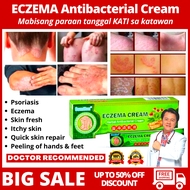 ECZEMA treatment cream gamot sa kati kati sa balat ointment for itchy skin ringworm antibacterial cr