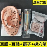 Wang Buliu X Seed Paste Ear Acupoint Paste Massage Ear Mo Wangbuliuxing Seed Ear Acupoint Patch Mass