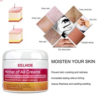 ACERVER Eelhoe Eczema Cream Psoriasis Cream，skincare，treat Psoriasis ，mother Of All Skin Creams,treatment Dermatitis Eczematoid Psoriasis Moisturizing