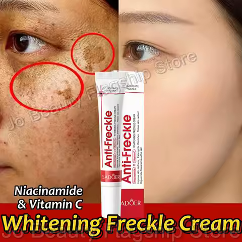 Whitening Freckle Cream Remove Dark Spots Anti Freckle Face Creams Niacinamide Fade Pigmentation Mel