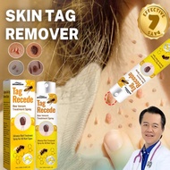 Bee Venom Spray Tag Recede Wart Remover Skin tag remover Ubat ketuat Mole remover Ketuat remover Ski