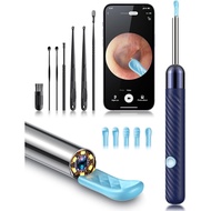Ear Wax Removal Tool Camera-Ear Wax Removal Kit-Ear Cleaner with Camera-1080P HD Ear Camera with 6 E