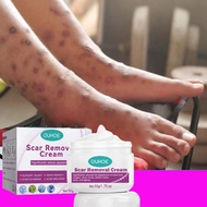 100% effective scar removal cream 50g peklat remover legit scars remover original peklat remover old