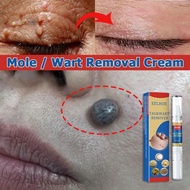 ubat ketuat kutil ubat buang kutil ketuat tahi lalat biji kolestrol skin tag remover Warts removal c