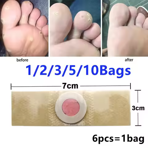 1/2/3/5/10Bags Painless Medical Plaster Warts Thorn Feet Callus Chicken Eye Treatment Sticker Feet C